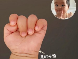 口咬的方法及做法图解—如何用口咬？口咬的方法及做法图解