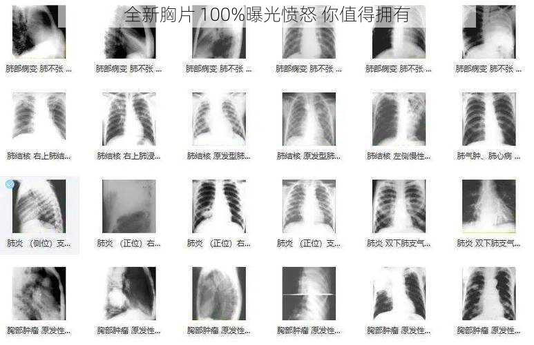 全新胸片 100%曝光愤怒 你值得拥有