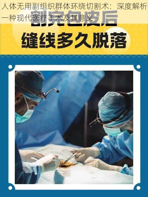 人体无用副组织群体环绕切割术：深度解析一种现代医疗手术及其意义