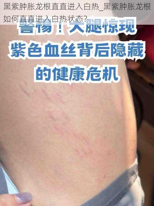 黑紫肿胀龙根直直进入白热_黑紫肿胀龙根如何直直进入白热状态？