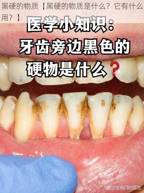 黑硬的物质【黑硬的物质是什么？它有什么用？】