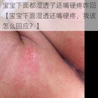 宝宝下面都湿透了还嘴硬疼咋回【宝宝下面湿透还嘴硬疼，我该怎么回应？】